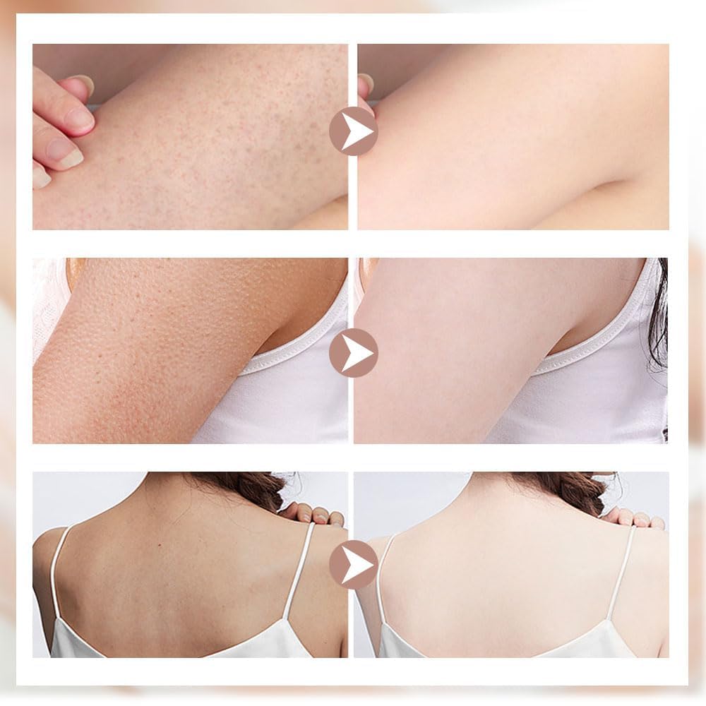 Upgraded 2-in-1 Sunflower Bath Ball Exfoliating Bath Sponge Cleaning Brush, Super Soft Sunflower Suction Cup Bath Ball, Sponge Mesh Pouf Shower Ball